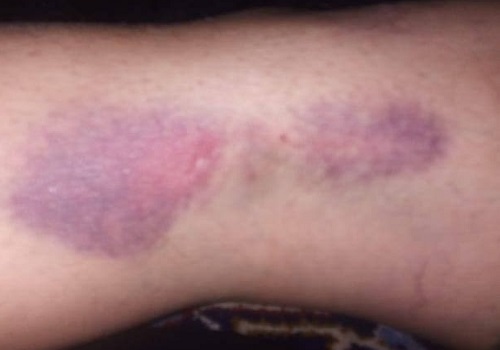 ماجرای ضرب و شتم زنان روستای ذهبدی بشاگرد از سوی نیروی انتظامی ماجرای ضرب و شتم زنان روستای ذهبدی بشاگرد از سوی نیروی انتظامی