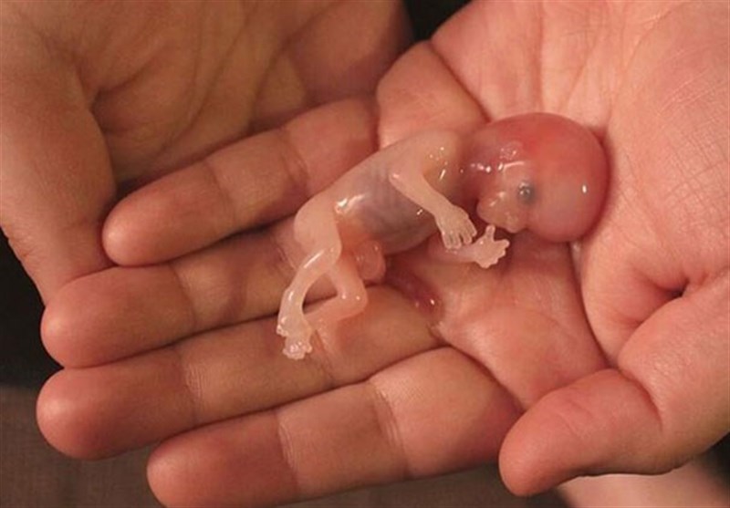کشتار جنین‌های مشروع به دست والدین/ به ازای هر سه تولد یک سقط جنائی داریم!