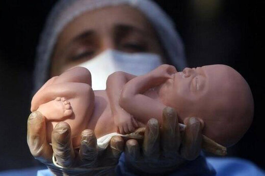 کشتار جنین‌های مشروع به دست والدین/ به ازای هر سه تولد یک سقط جنائی داریم!