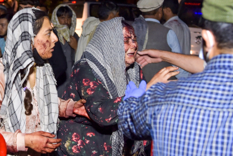 مردم عادی افغانستان متحمل بیشترین تلفات شدند